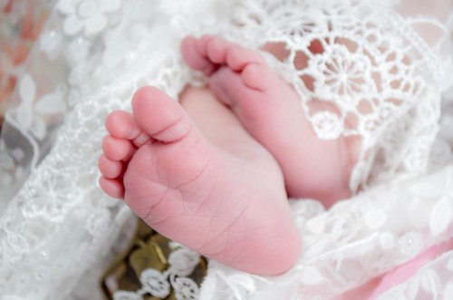 איסור סירוס בקשירת חצוצרה אחת